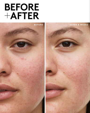 Fenty Skin Vault 5-Piece AM + PM Skincare Essentials