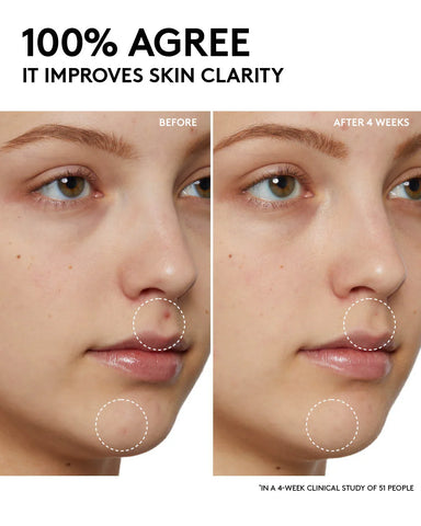 Cherry Dub Pore Purify'r Gel Cleanser with Niacinamide + Aloe Juice