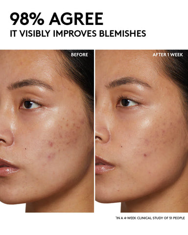 Fenty Skin Start’rs Full-Size Bundle: Oily Skin Edition