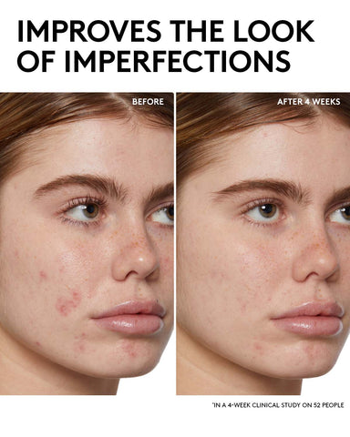 Cherry Dub BHA Toner with Salicylic Acid + Aloe Juice